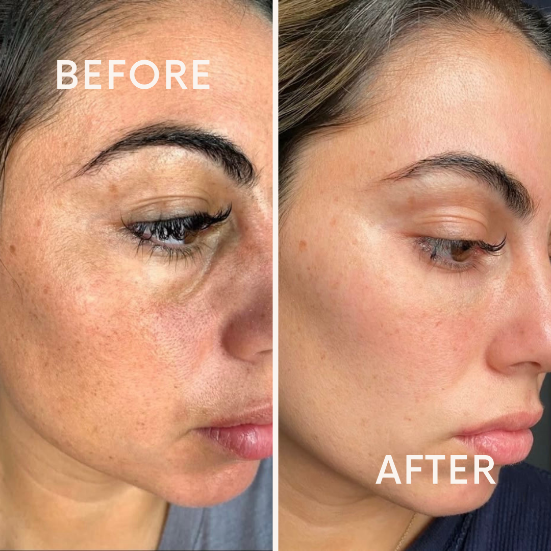 SeRyne Korean collagen | anti-Aging, wrinkles