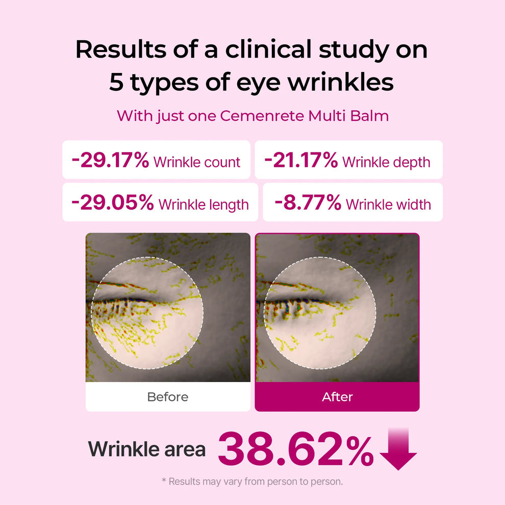 SeRyne Korean collagen | anti-Aging, wrinkles