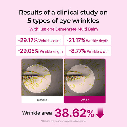 SeRyne Korean collagen | anti-Aging, wrinkles