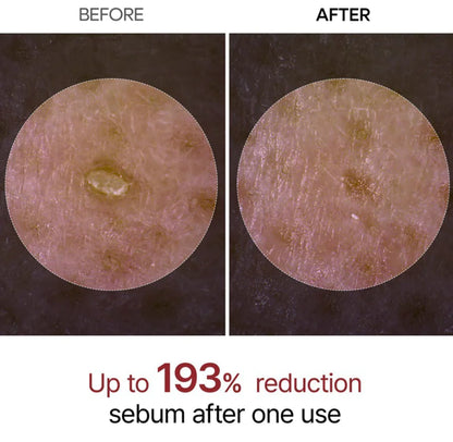 Rice Exfoliating Ampoule